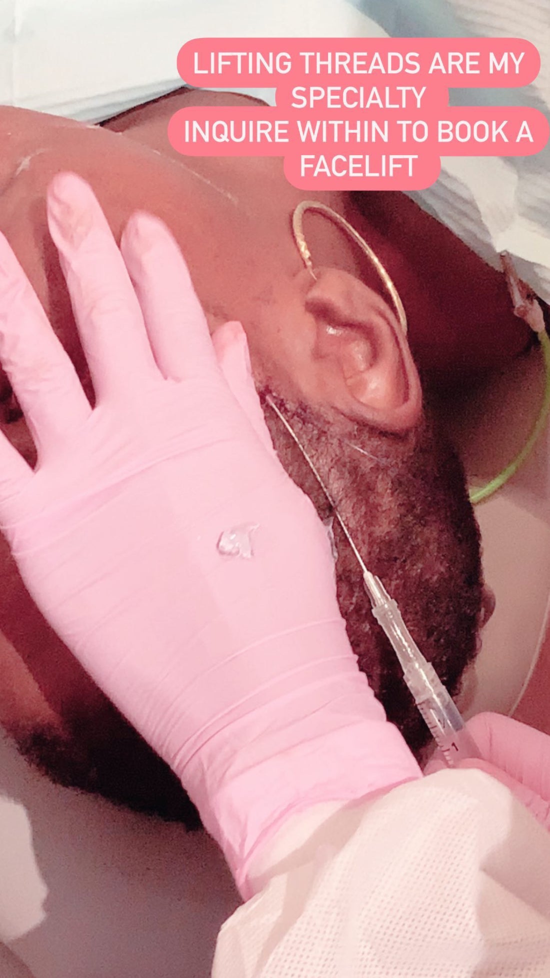 TheeLipDoctor Lifting Thread Course L1